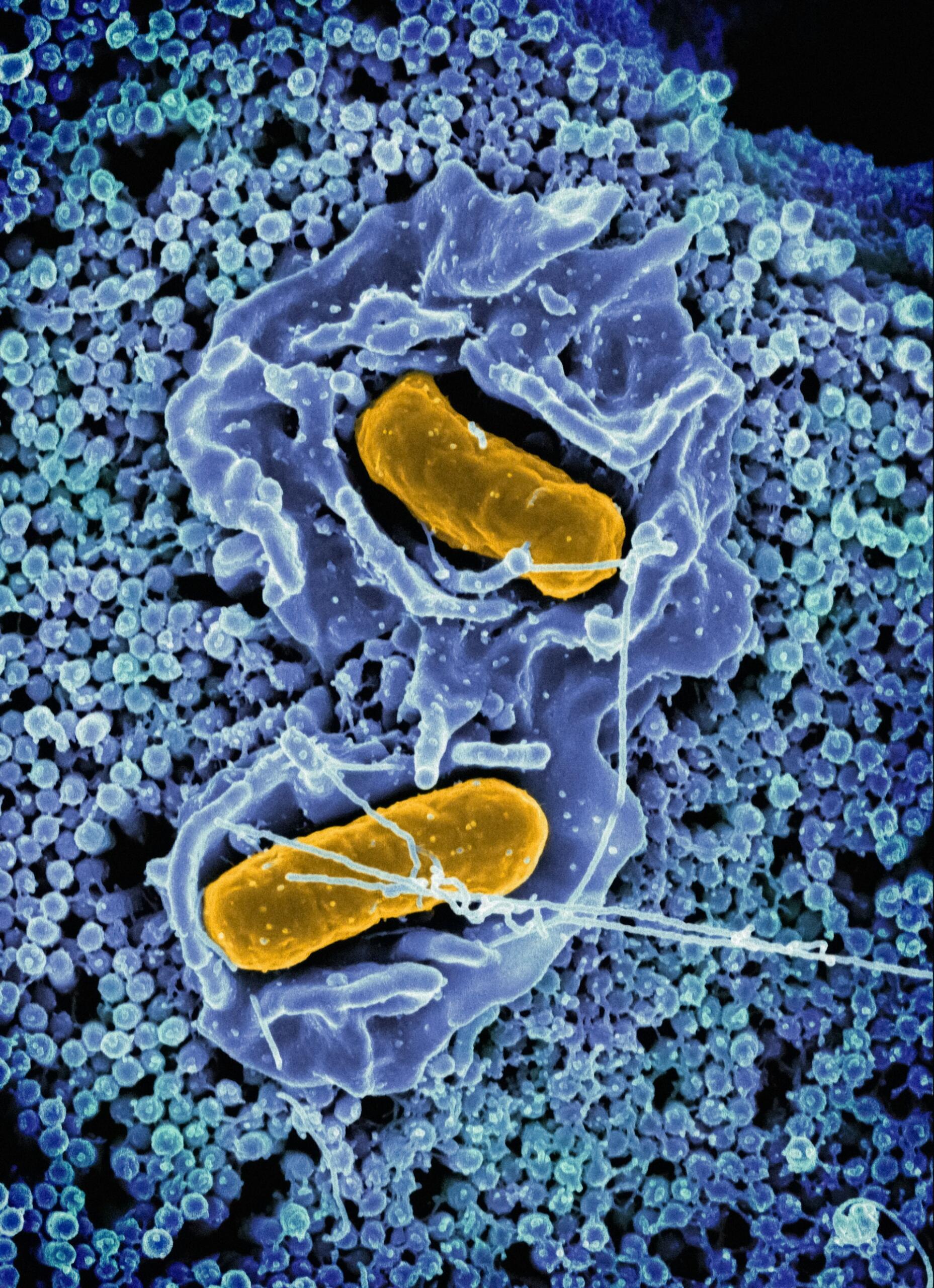 Microbioma