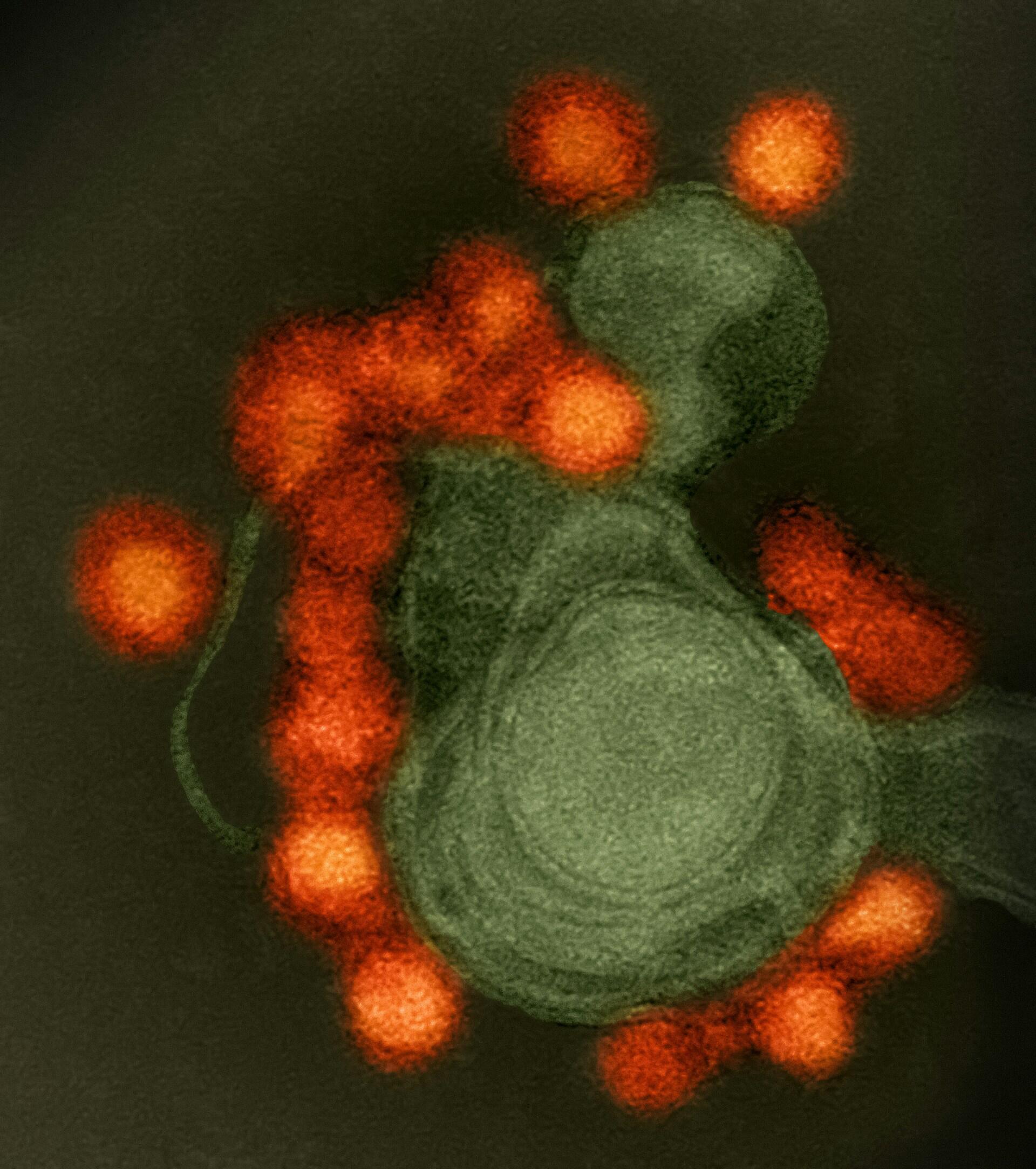 virus