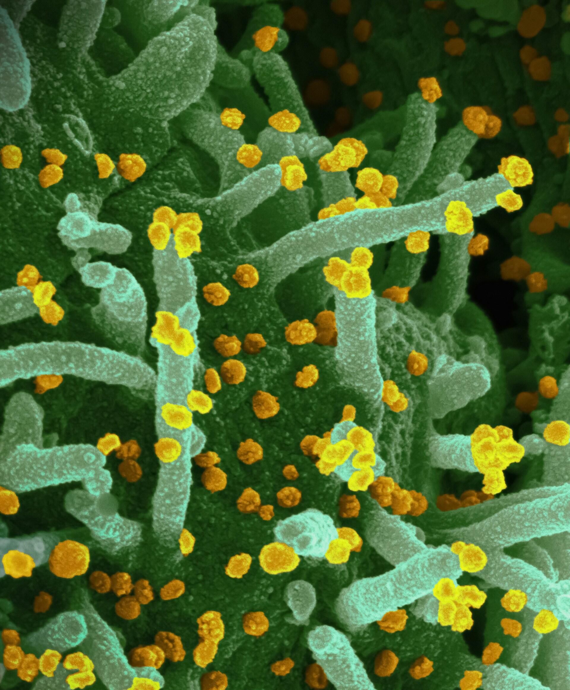 Conjunto de cilindros verdes con puntos amarillos. 