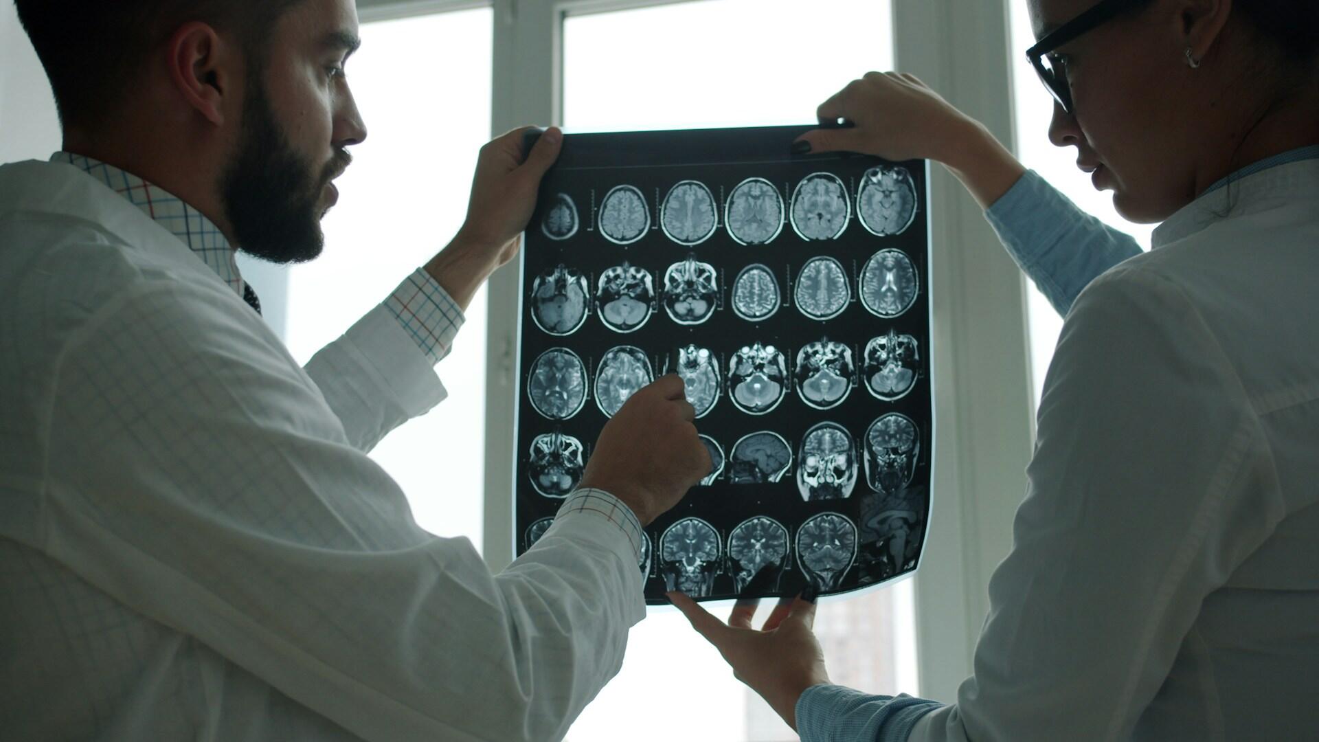 Sala de diagnóstico de un hospital, médicos analizando una resonancia magnética cerebral a contraluz. Fuente: Pexels.
