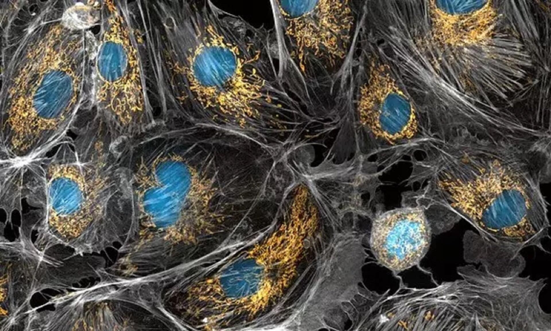 Cells coloured blue, surrounded with a golden hue, with white filaments. 