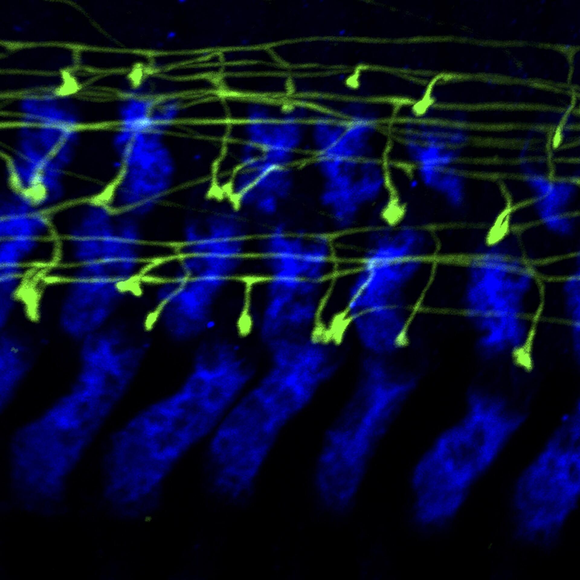 Nerve cells with their nuclei in yellow.