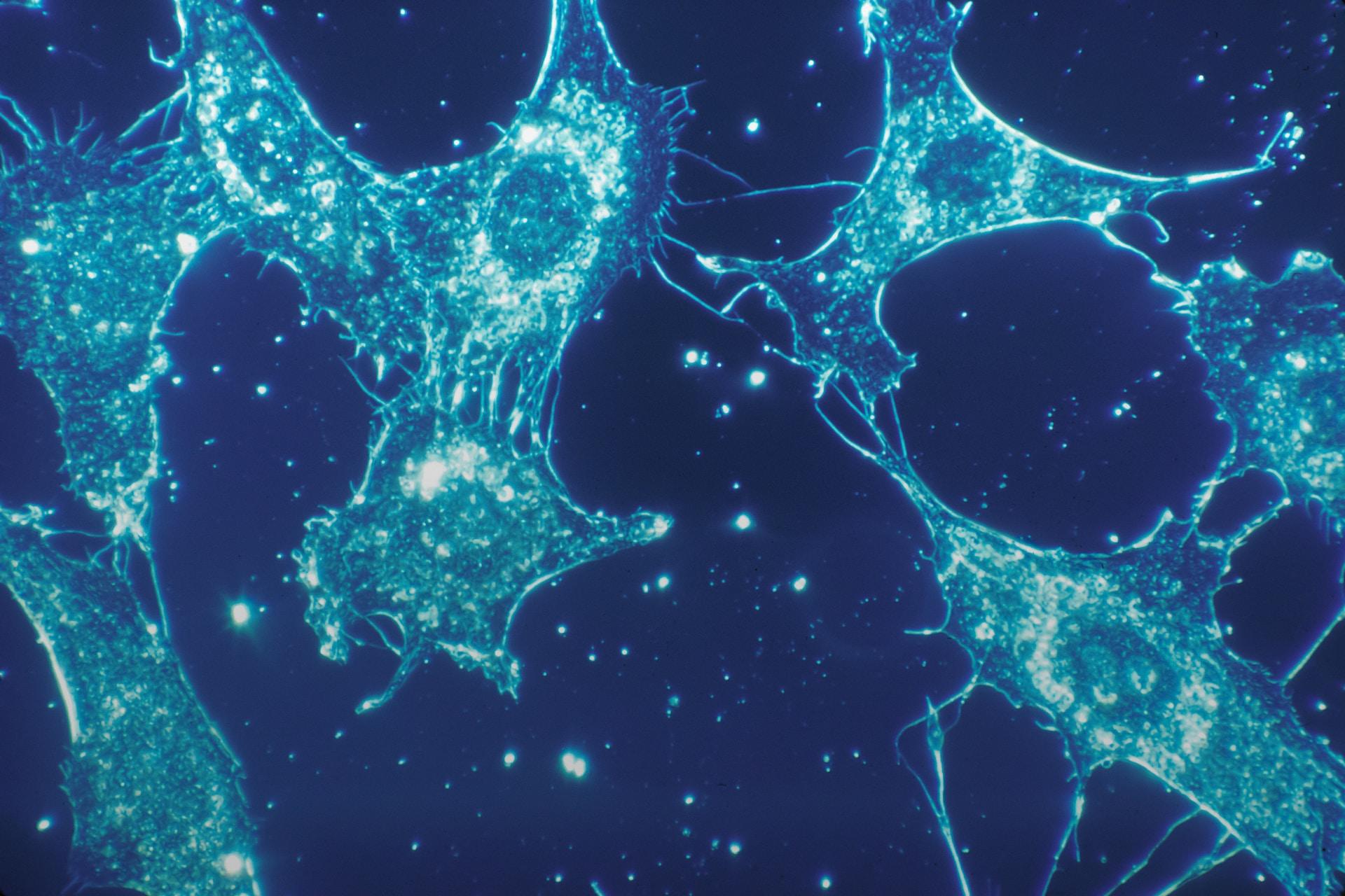 A magnified image of human connecting tissue under a microscope.