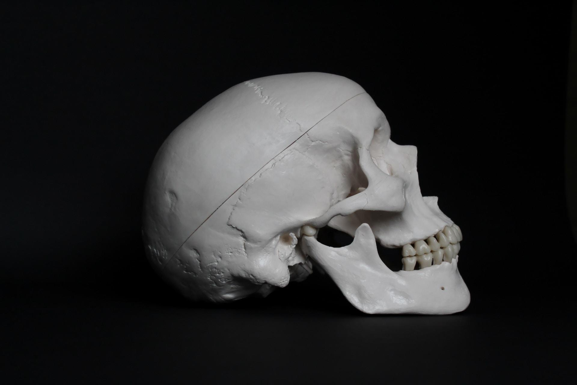 A human skull.