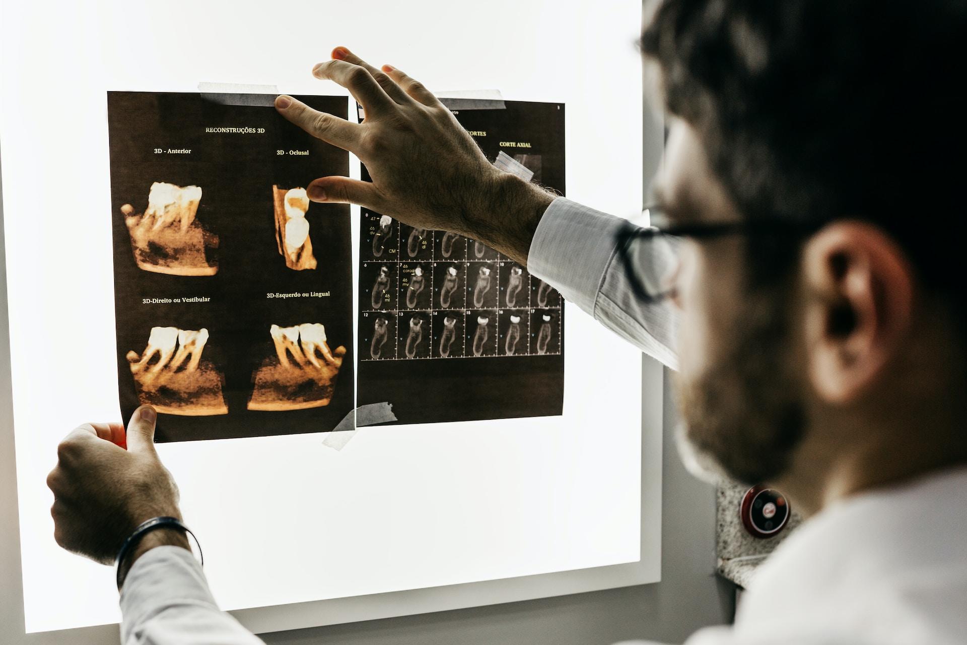 A dentist looking at x-rays.