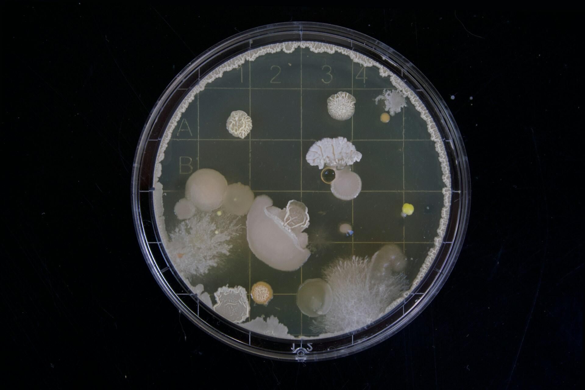Bacterial cultures in a dish.