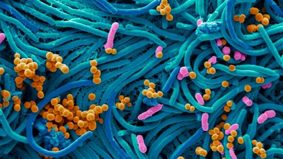 Microbiology will allow you to learn all about the organisms to small to see with our eyes