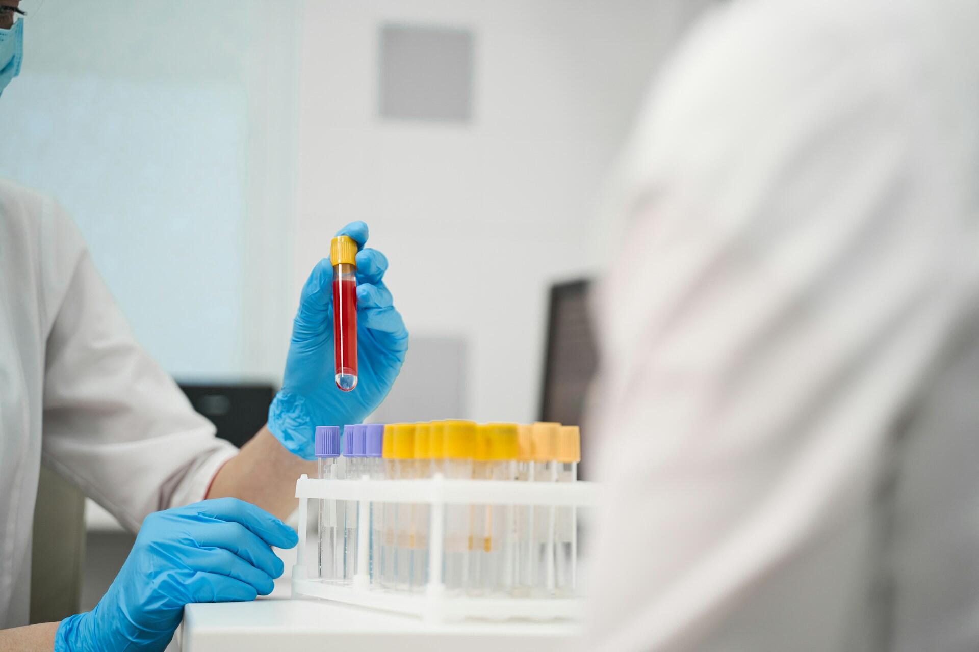 A lab technician in blue gloves holds a red-filled test tube in a clinical setting.