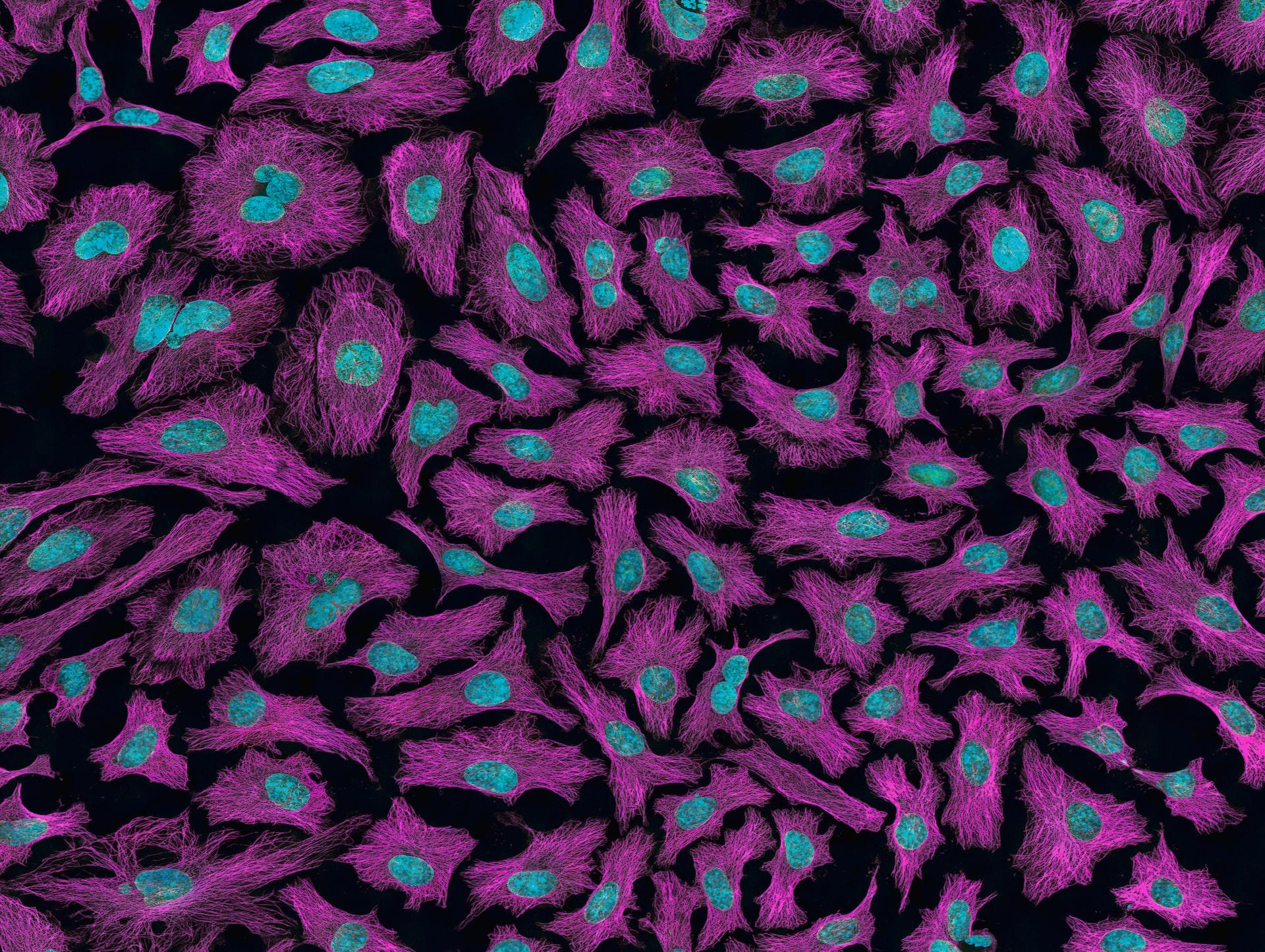 recherches nationales d'institut du cancer
