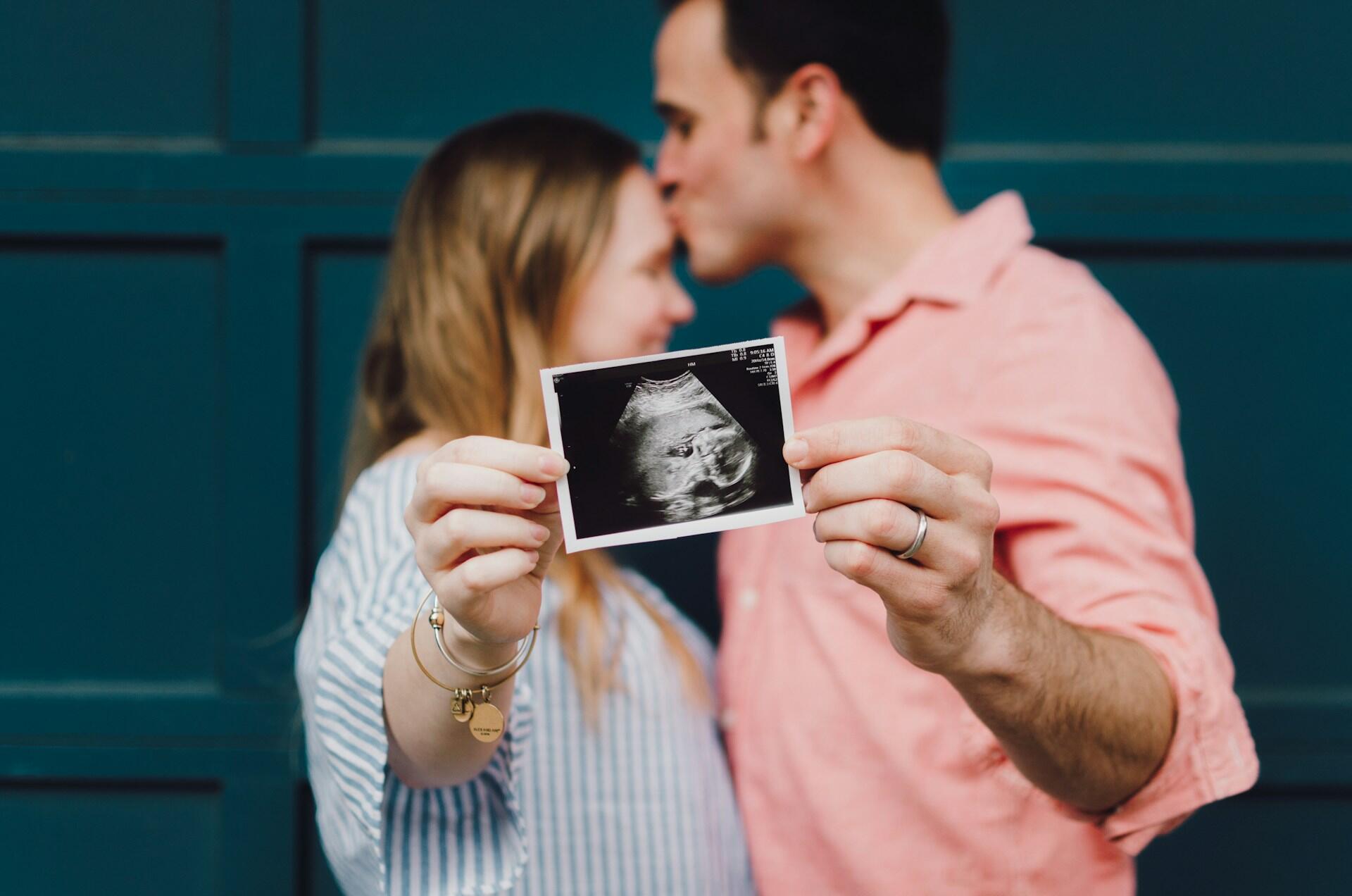 Imagem de um casal com uma foto de ultrassom na mão