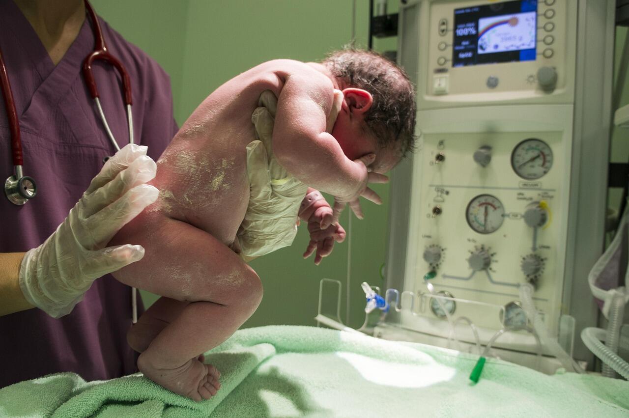 Foto de um médico dando tapinhas em um recém nascido