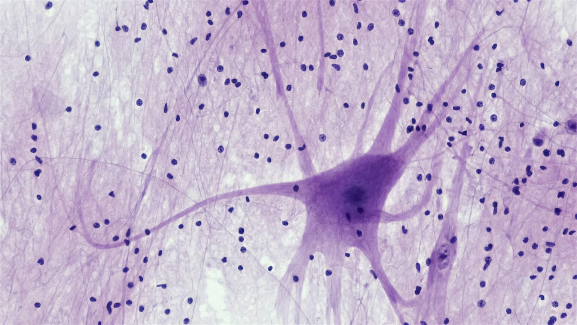 Imagem de um neurônio visto em um microscópio