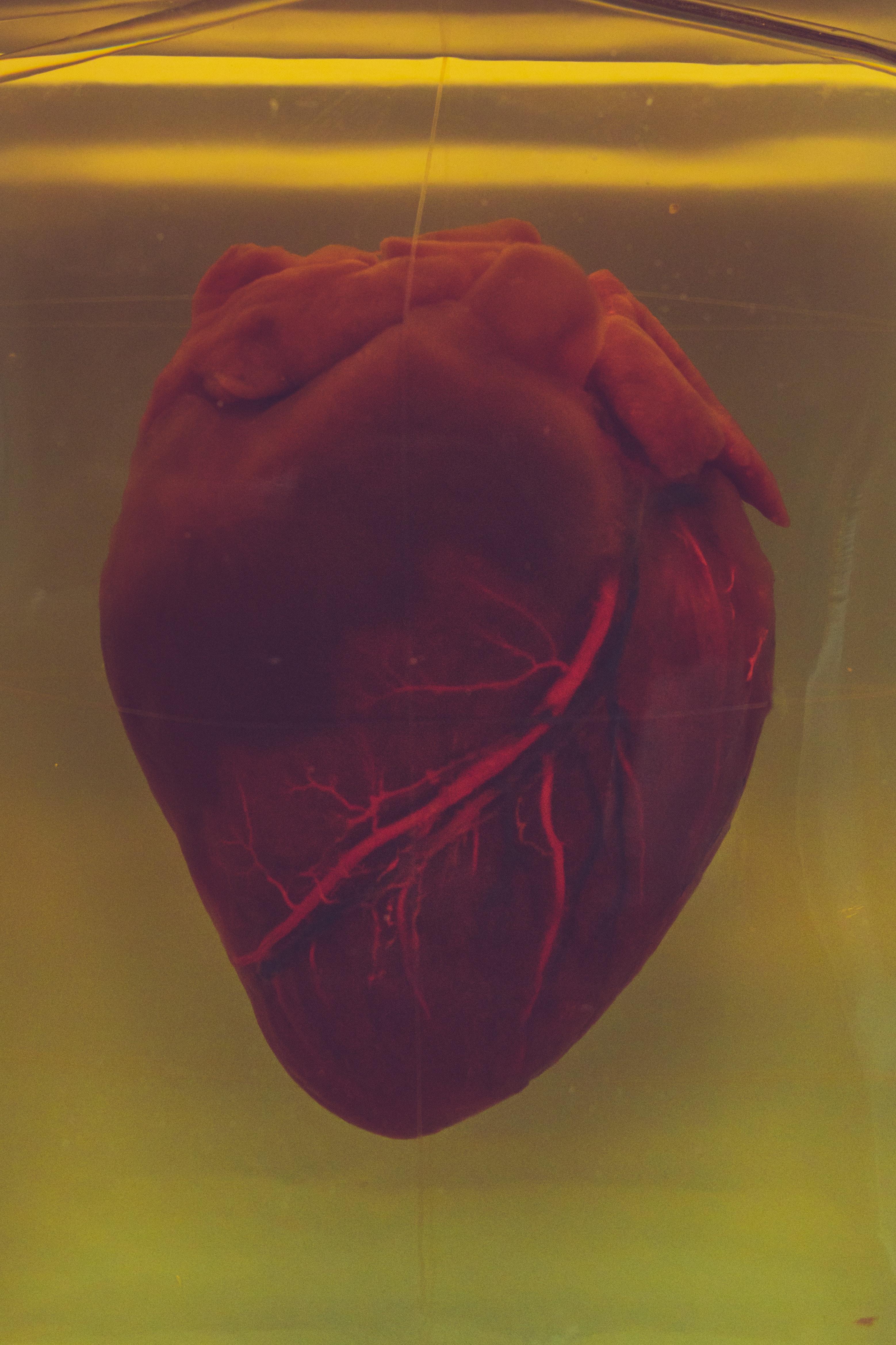heart photo