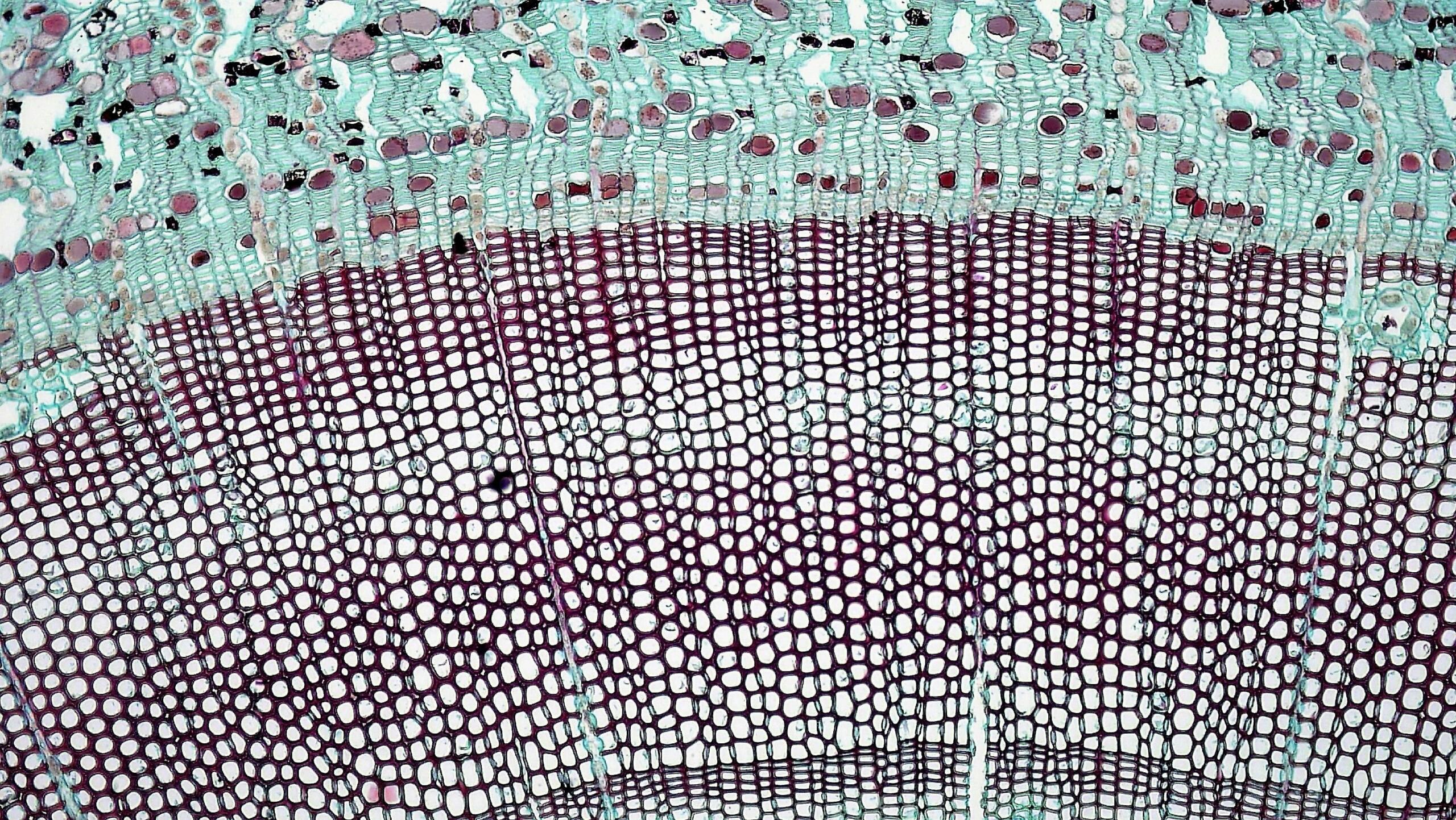 Close-up view of plant cells under a microscope, showing distinct cell walls and internal structures.