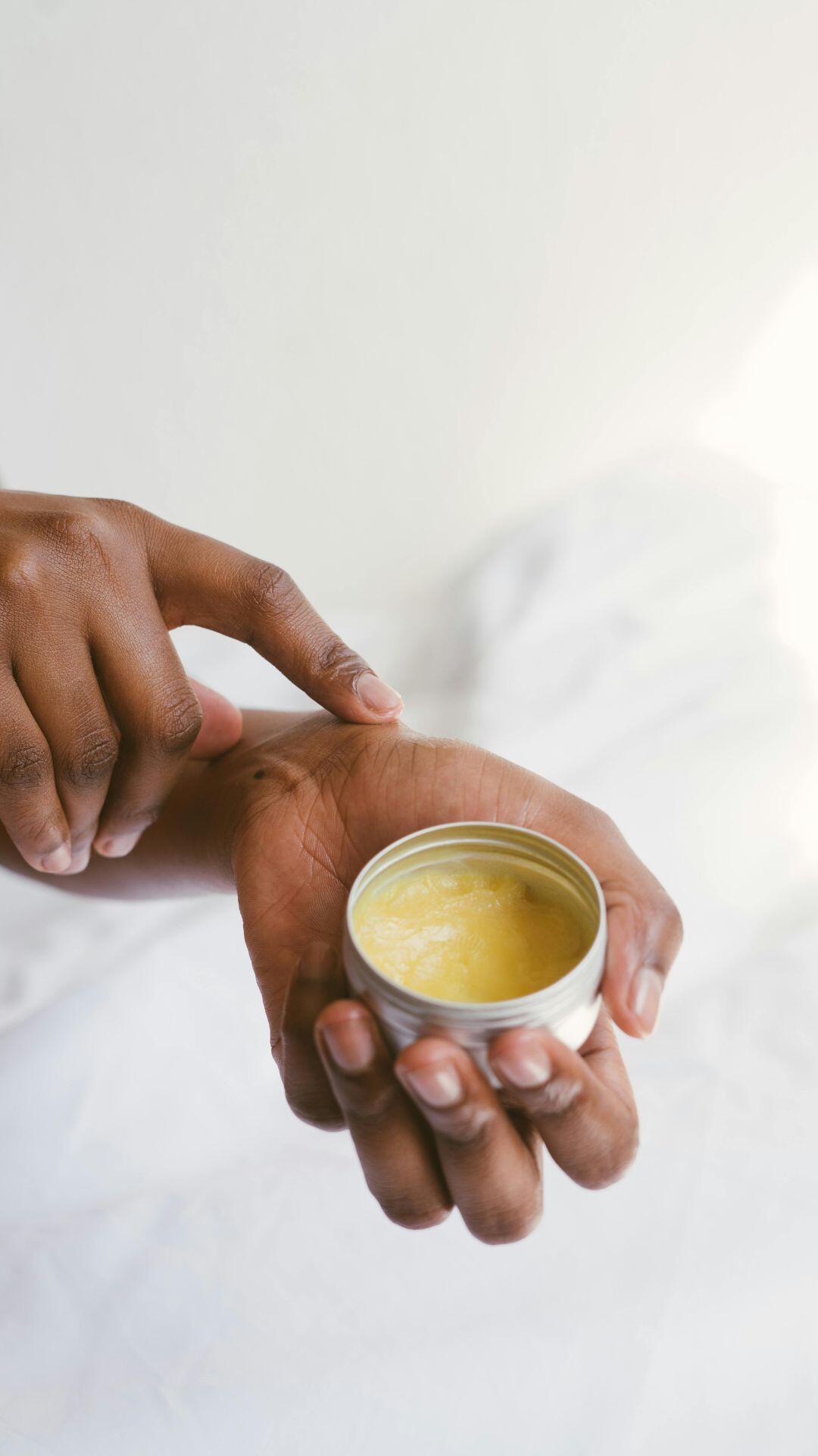 Close-up of hands applying ointment to skin for dermatological care.