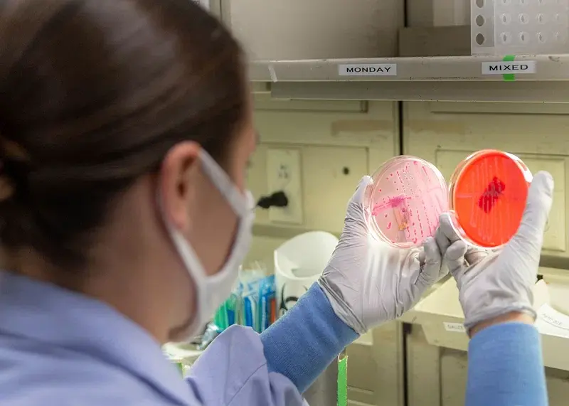 Scientist examining petri dishes with bacterial cultures.