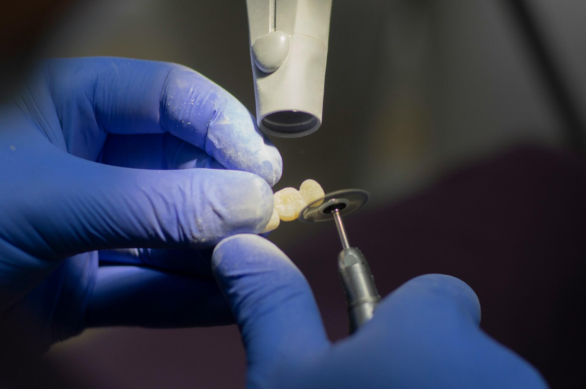a dentist shapes false teeth with a drill