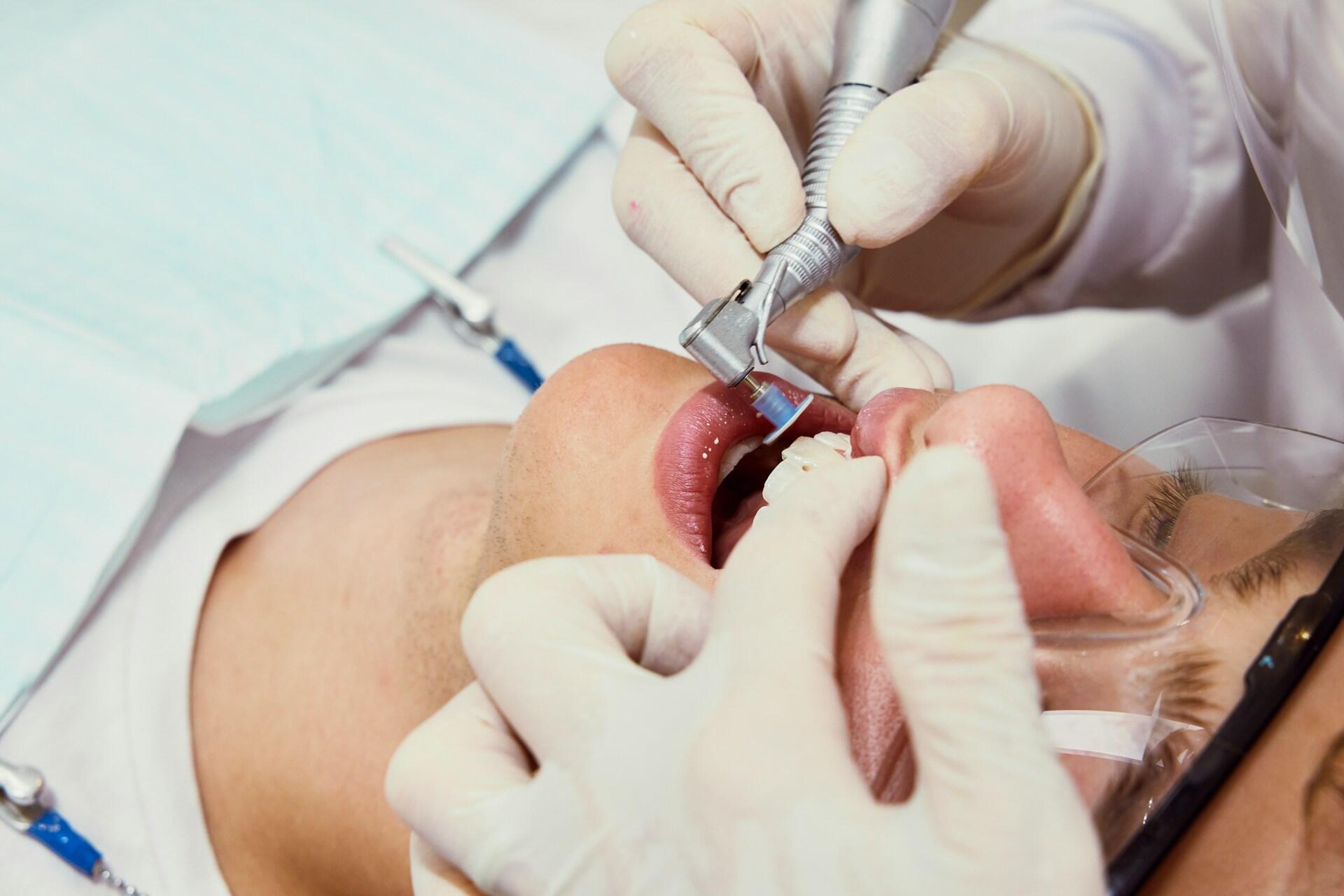 dental patient receiving dental cleaning while wearing safety goggles