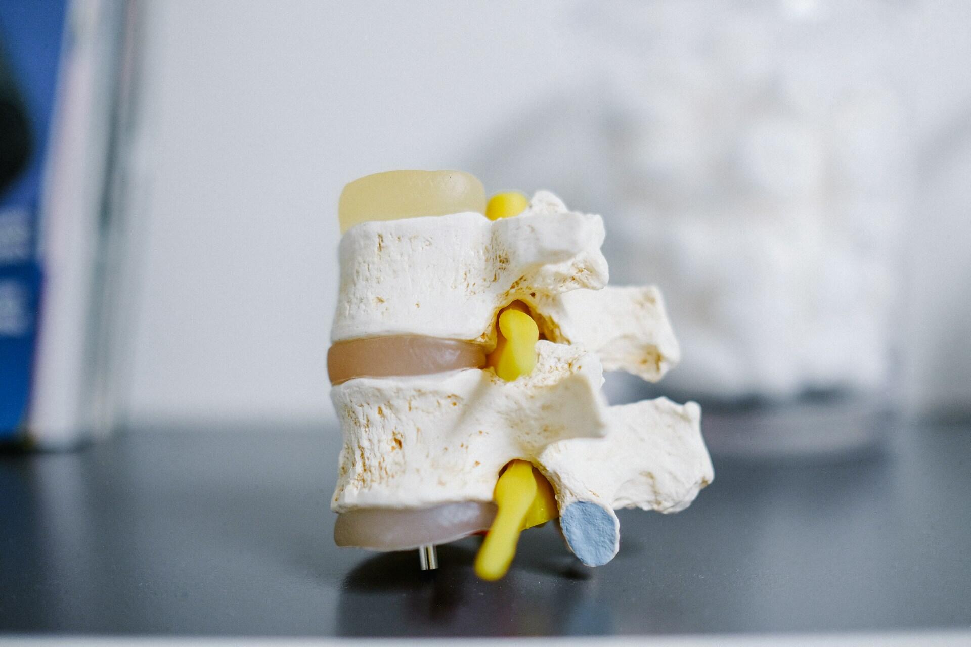 Model of human spine vertebrae with intervertebral discs and yellow nerve roots on a flat surface.