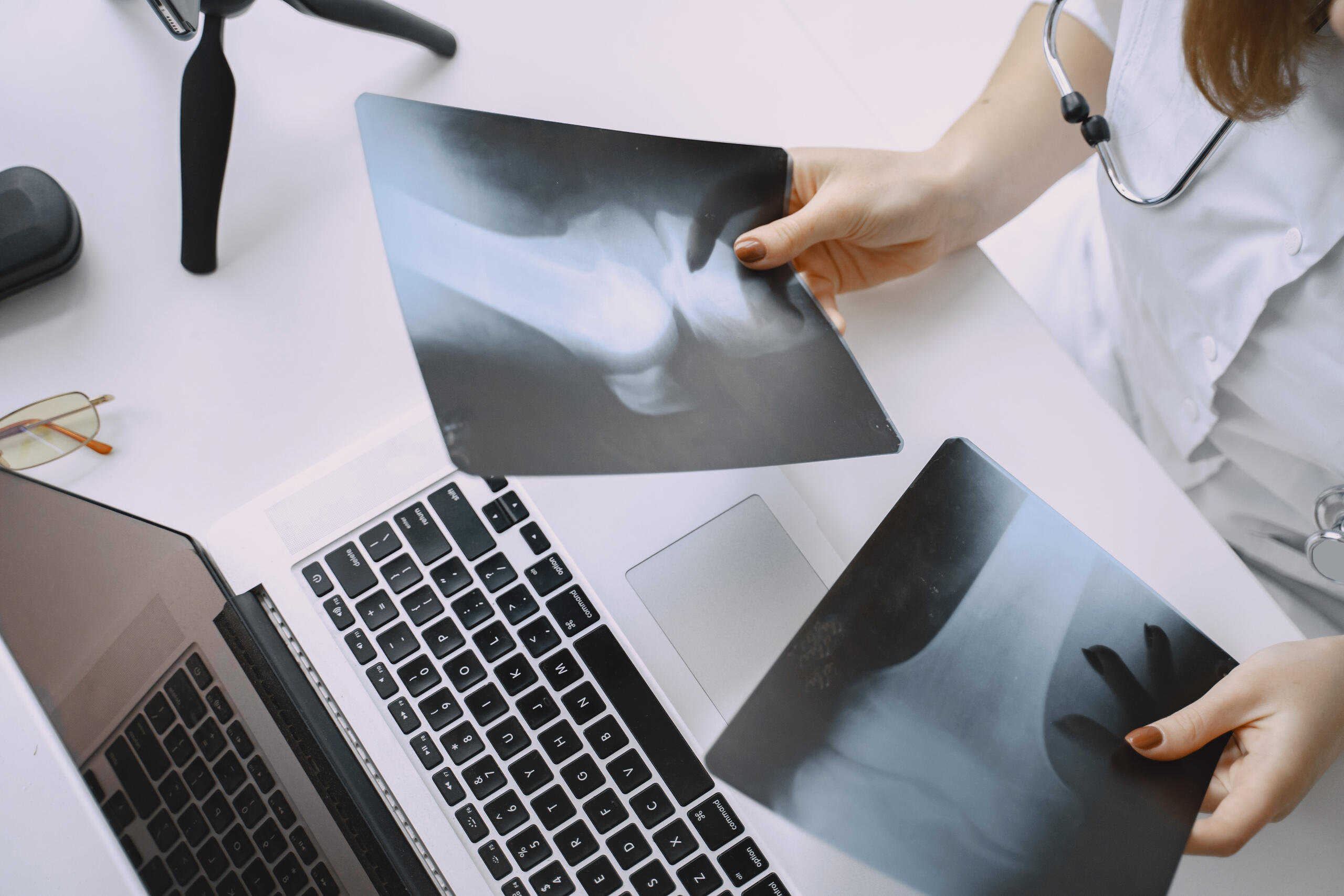 Vista cenital de una doctora revisando dos radiografías frente a su laptop