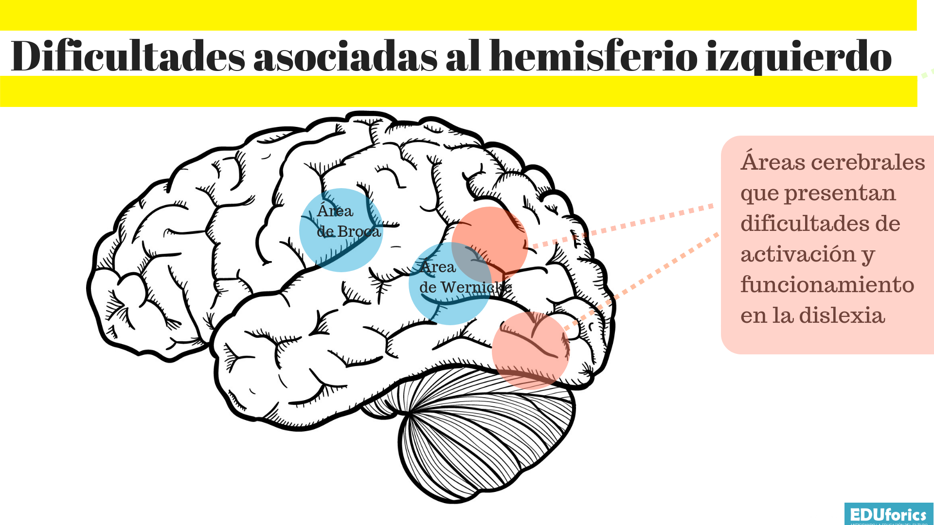 Cerebro