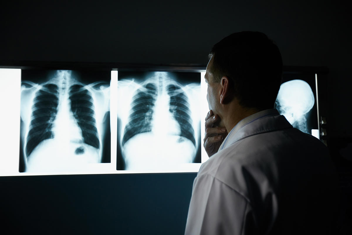 Médico viendo una radiografía