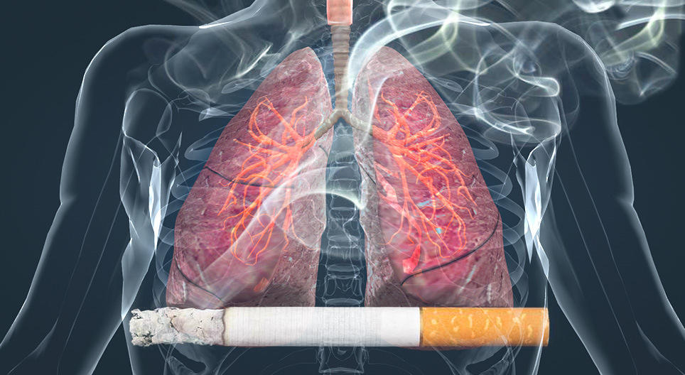 Representación de unos pulmones de fumador, y un cigarrillo muy grande