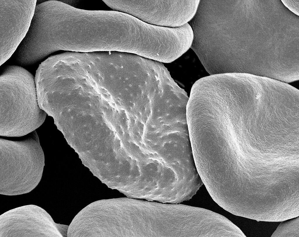 Micrografía de células sanguíneas infectadas con Plasmodium falciparum, parásito del Reino Protista causante de la malaria.