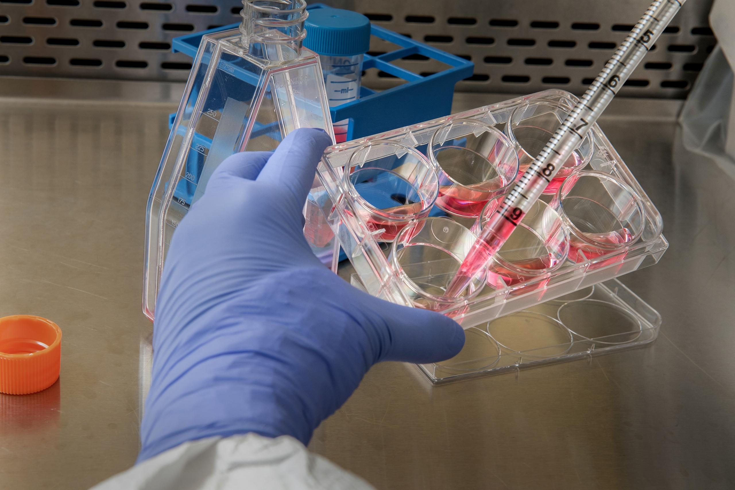en biolog arbejder med mikrobiologiske metoder