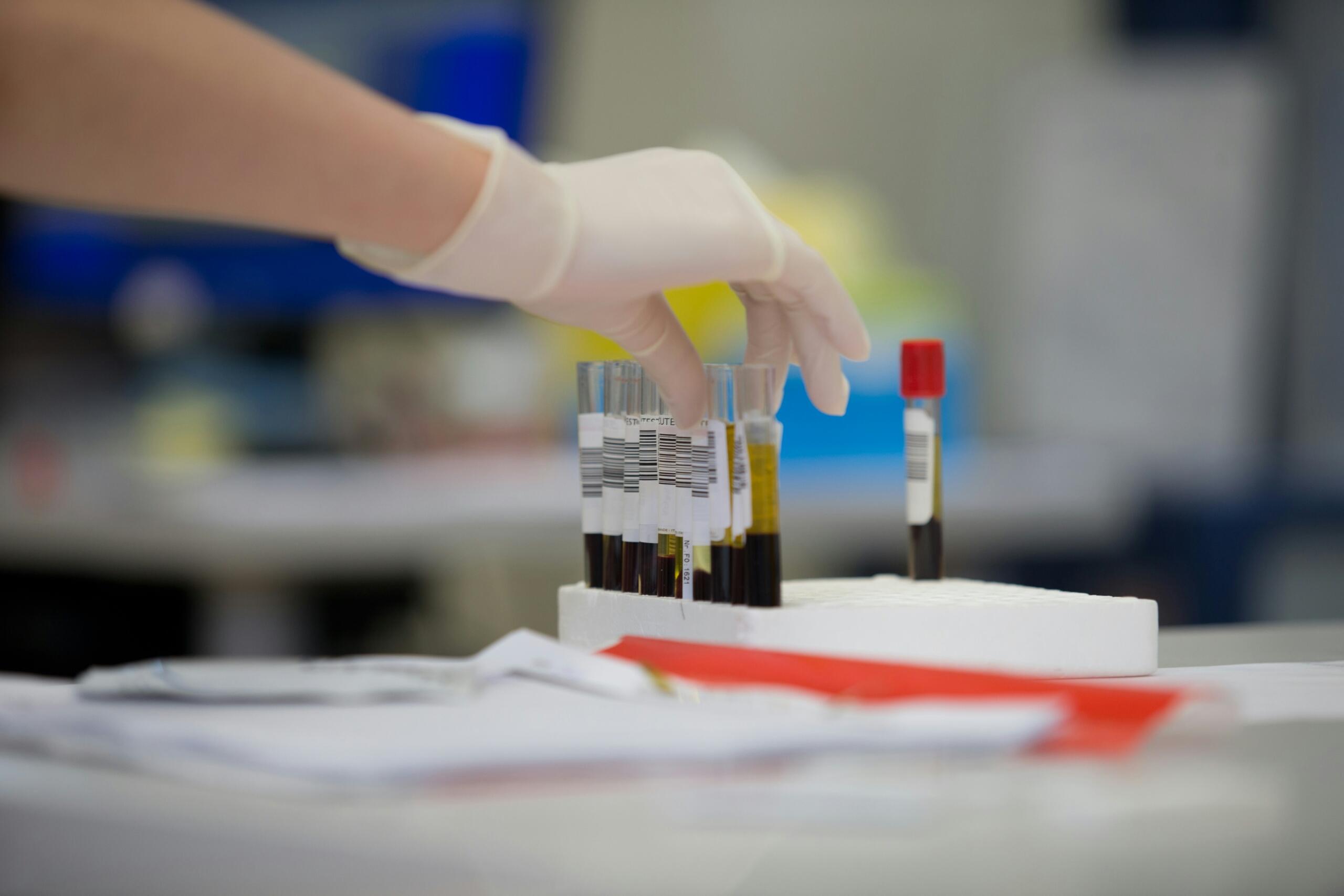 Kinnastatud käsi tõstab laboris vereproovidega katsuteid, mis illustreerivad bioanalüütilist keemiat.