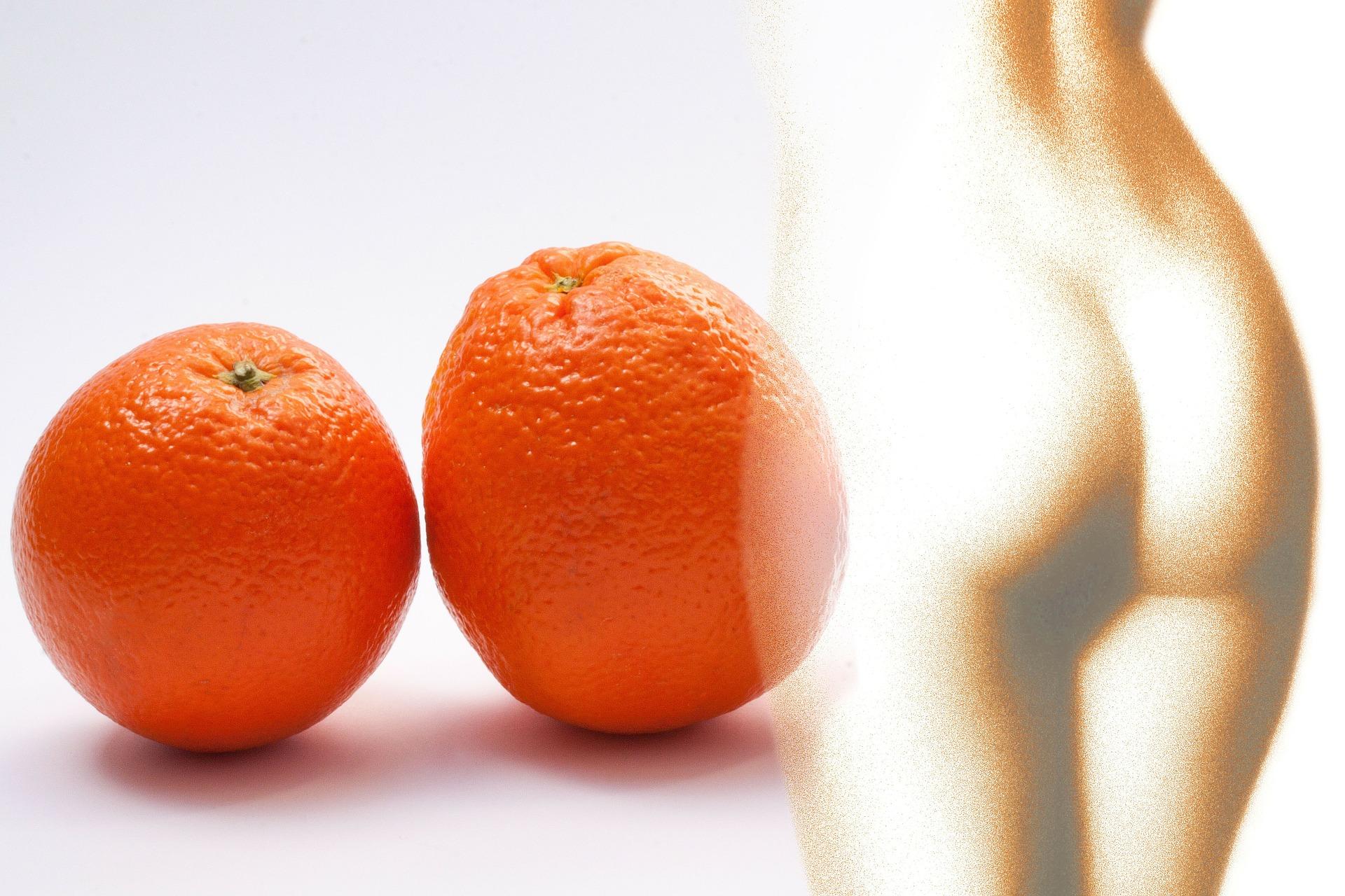 ¿En qué consiste la celulitis?