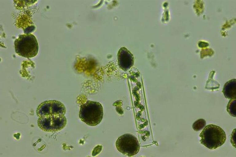 Imagen microscópica de algas verdes y diatomeas de diversas formas y tamaños sobre un fondo claro, que muestra un ecosistema acuático diverso y complejo.