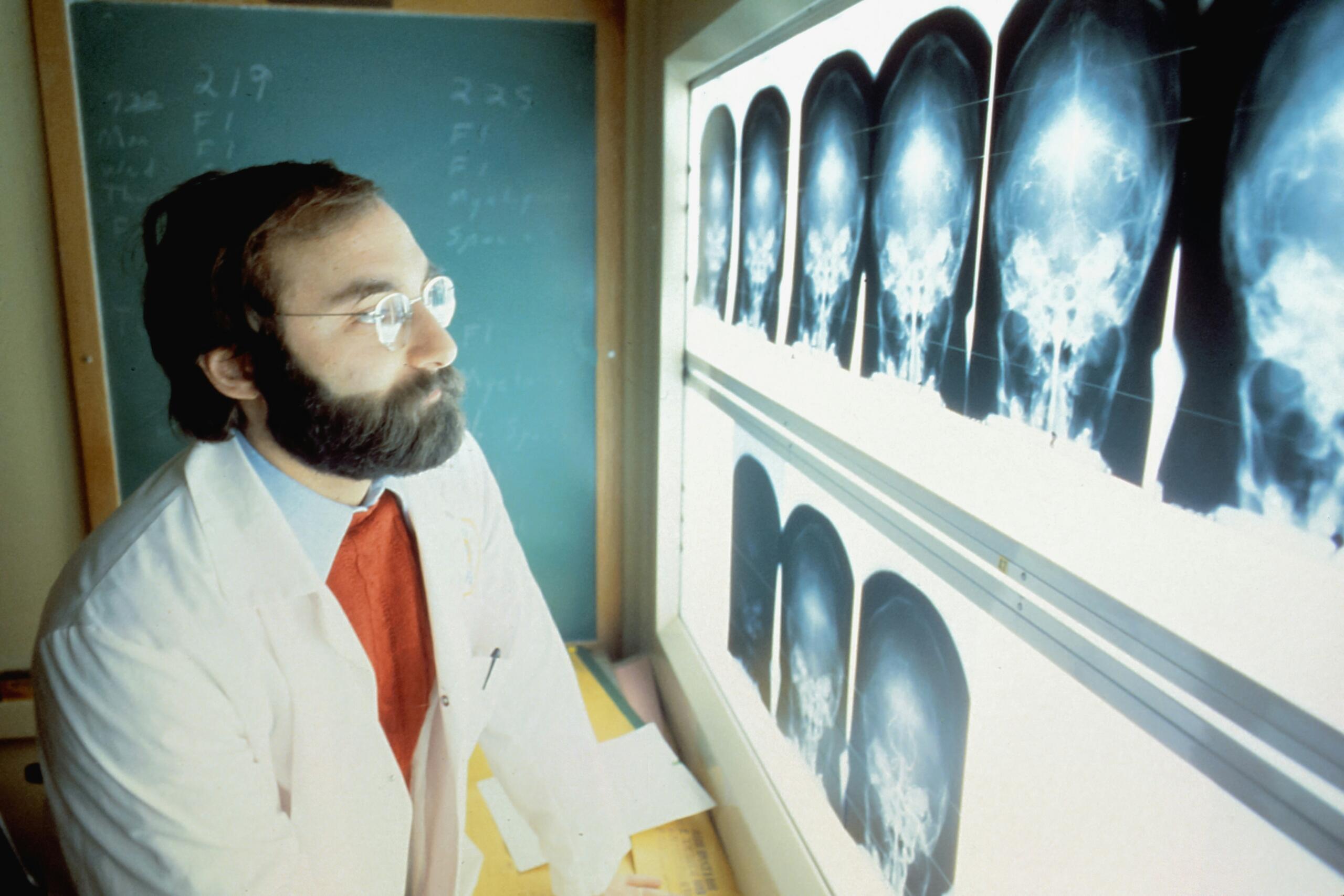 Un médico con bata blanca examina varias radiografías de cráneo que se muestran en una mesa de luz en una consulta médica.