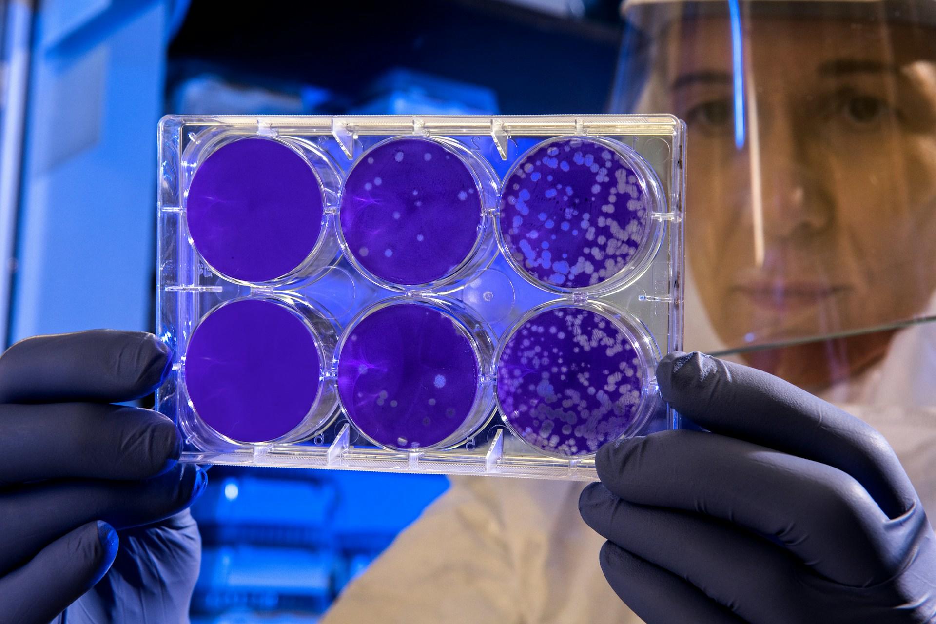 Persoon doet onderzoek naar DNA van organismen
