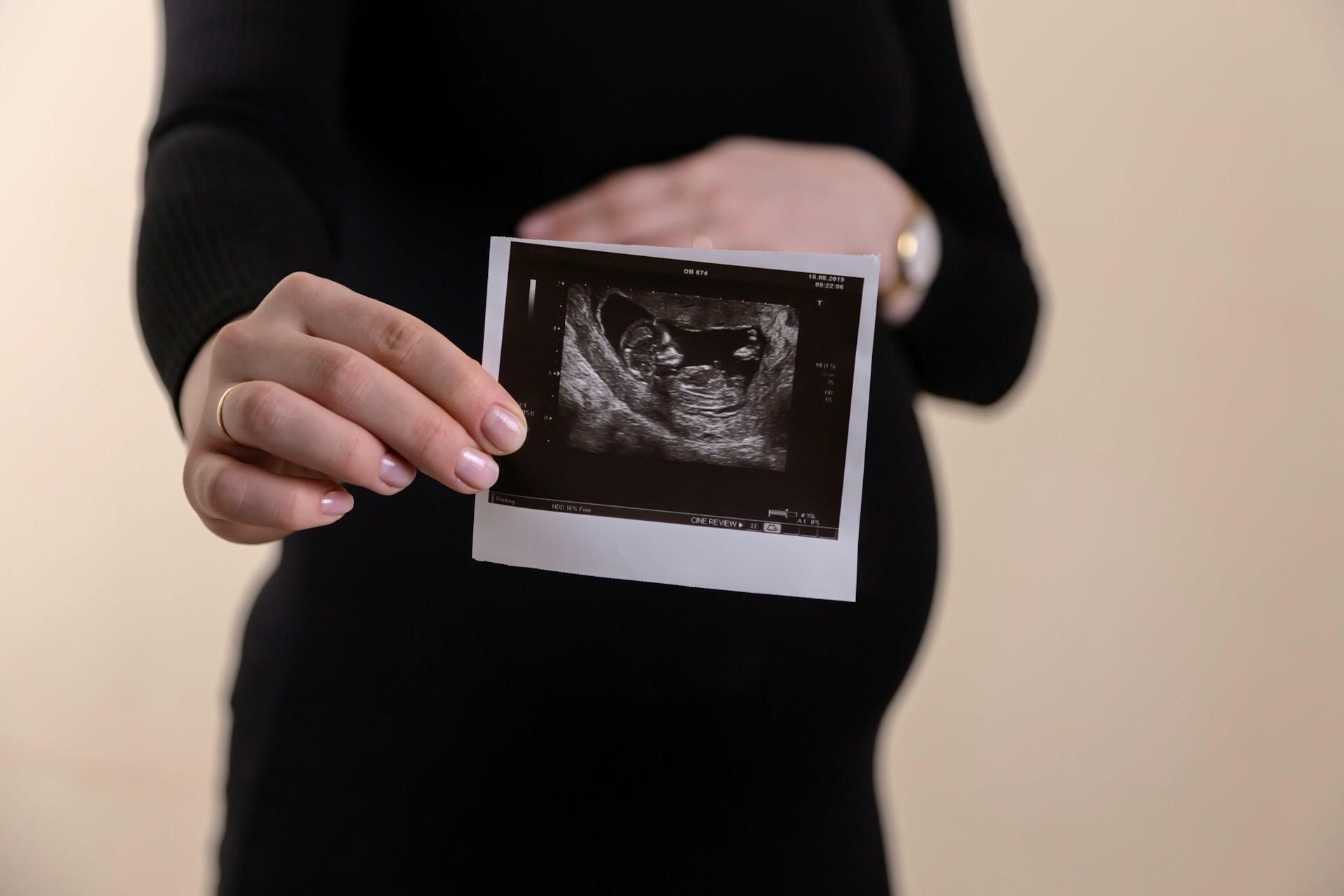 Echografie van baby in buik