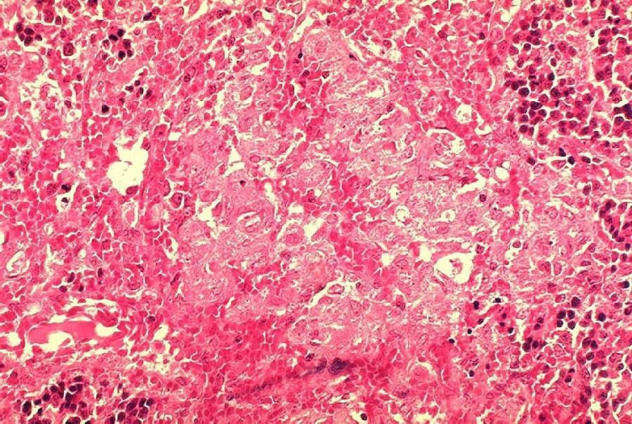 microscoop opname met brucellosis