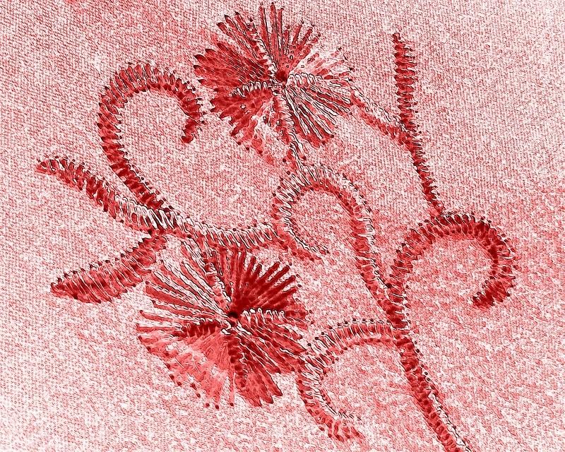 Quelle est le technique pour retirer une broderie ?
