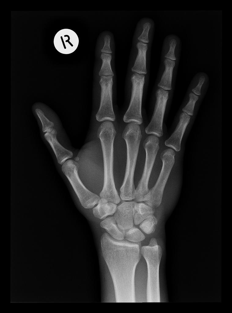 X-rays are an example of maths applied to well-being