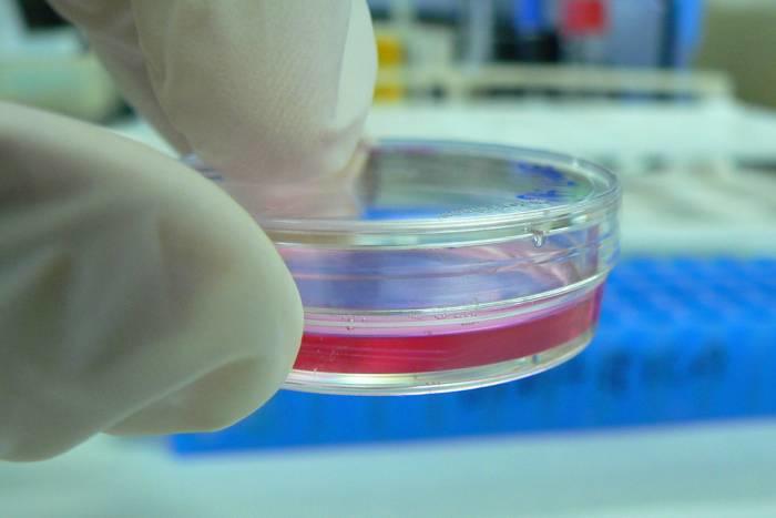 Cell Biology is one of the topics you will learn about on a BCSE Biology course.