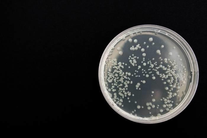 An infection is the process whereby an infectious agent invades cells and multiplies.