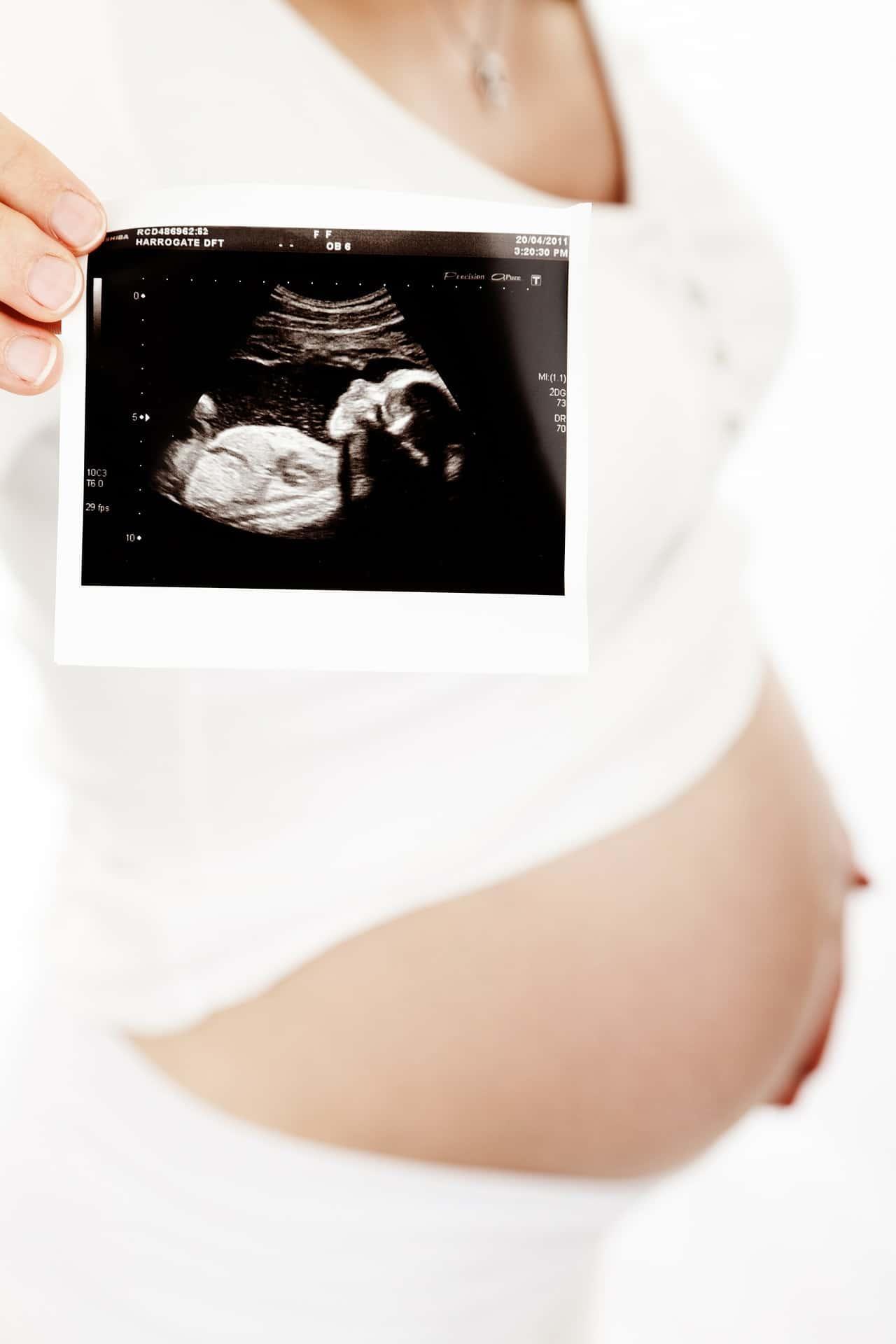 woman with ultrasound