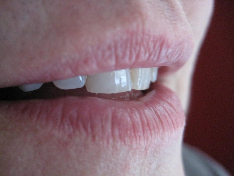 Practice speech exercises regularly.