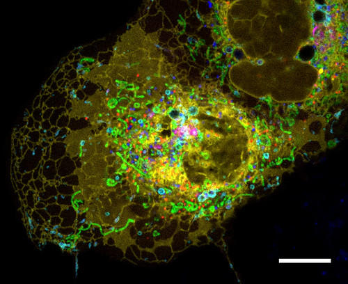 Cells look otherworldly when they are enhanced.