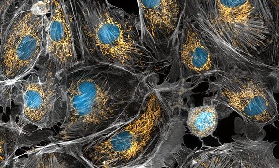 The golden mitochondria provides the organelles with power to function