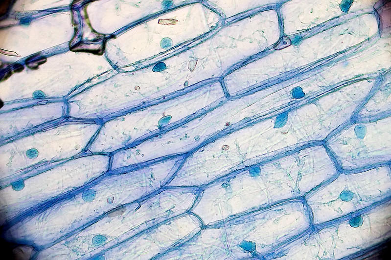 Onion skin cells' nucleus is clearly visible