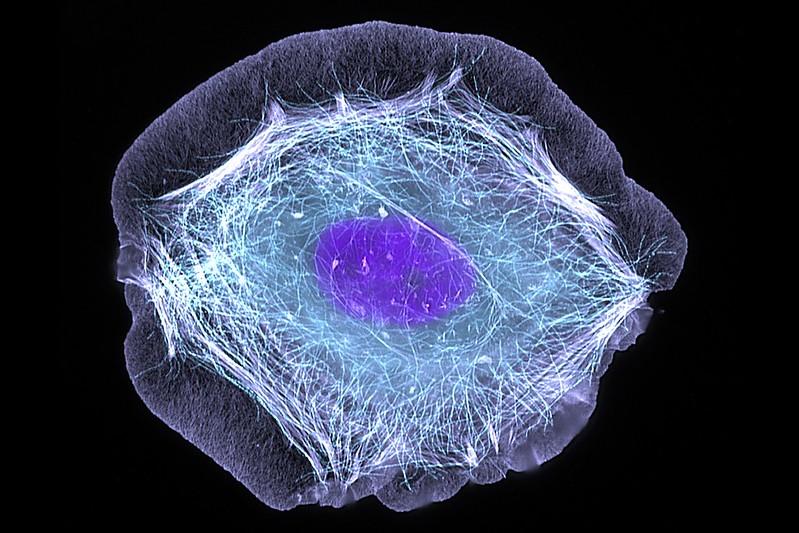 You can see this skin cell's nucleus and organelles