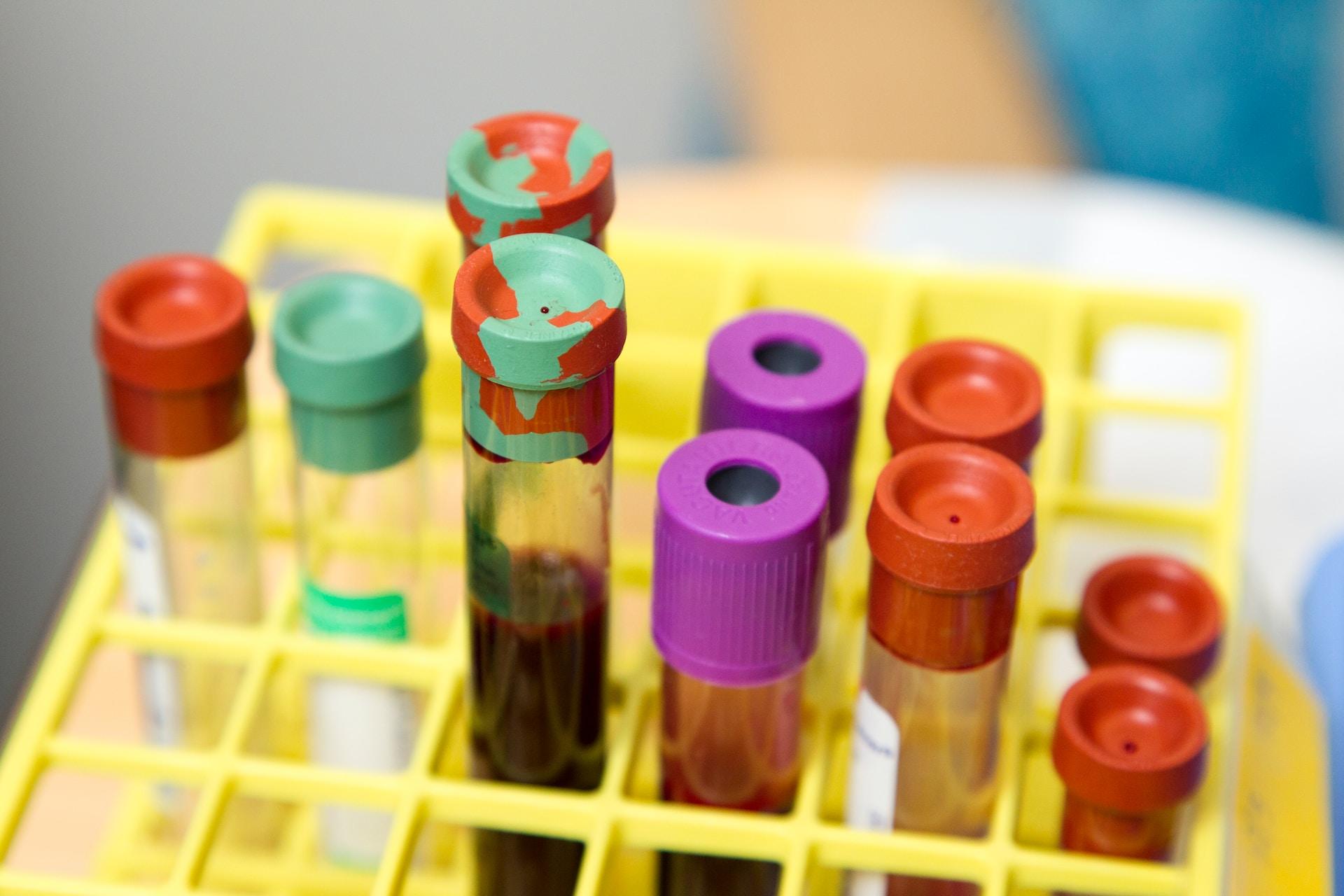 A rack of test tubes.
