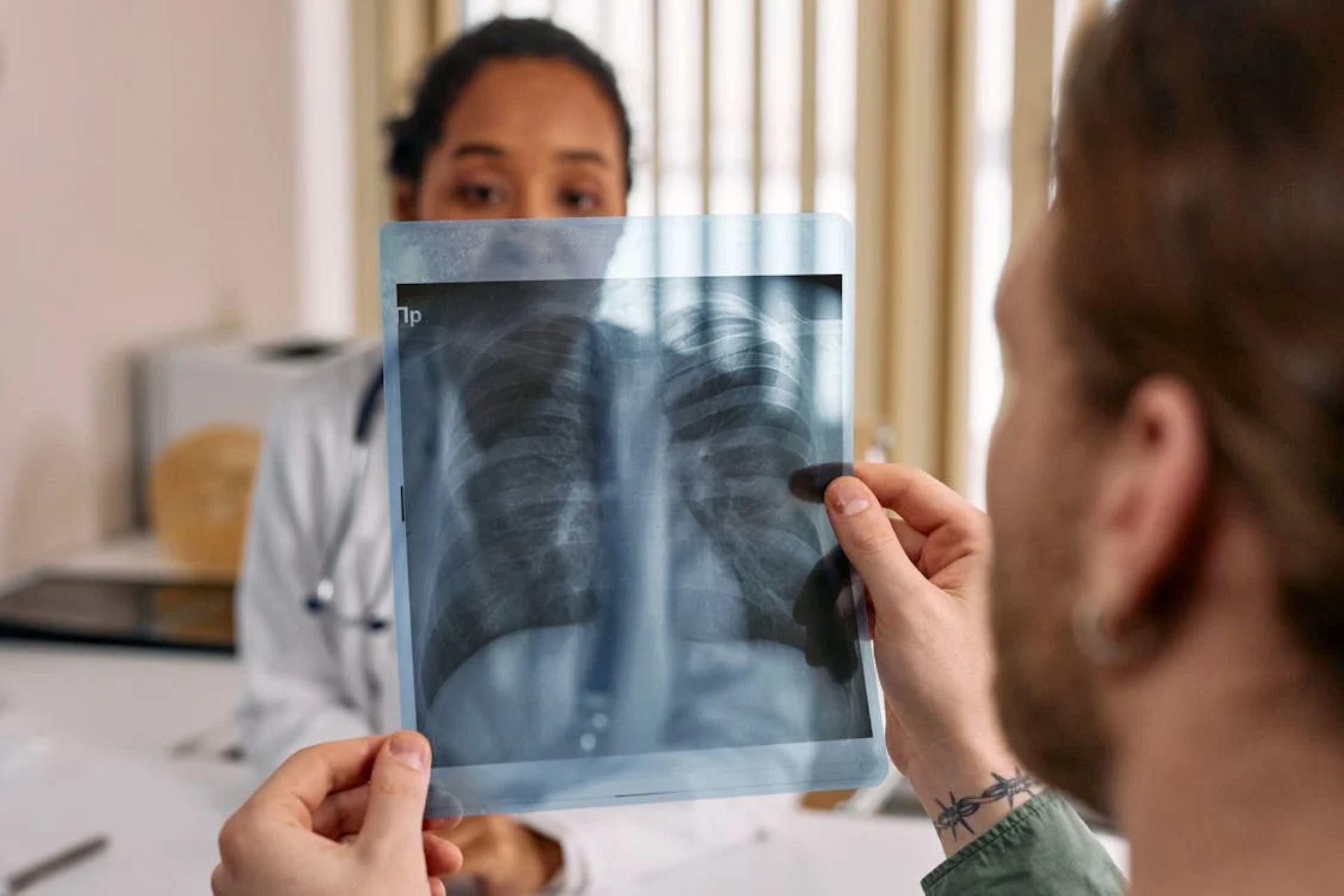 Radiologist examining an X-ray film