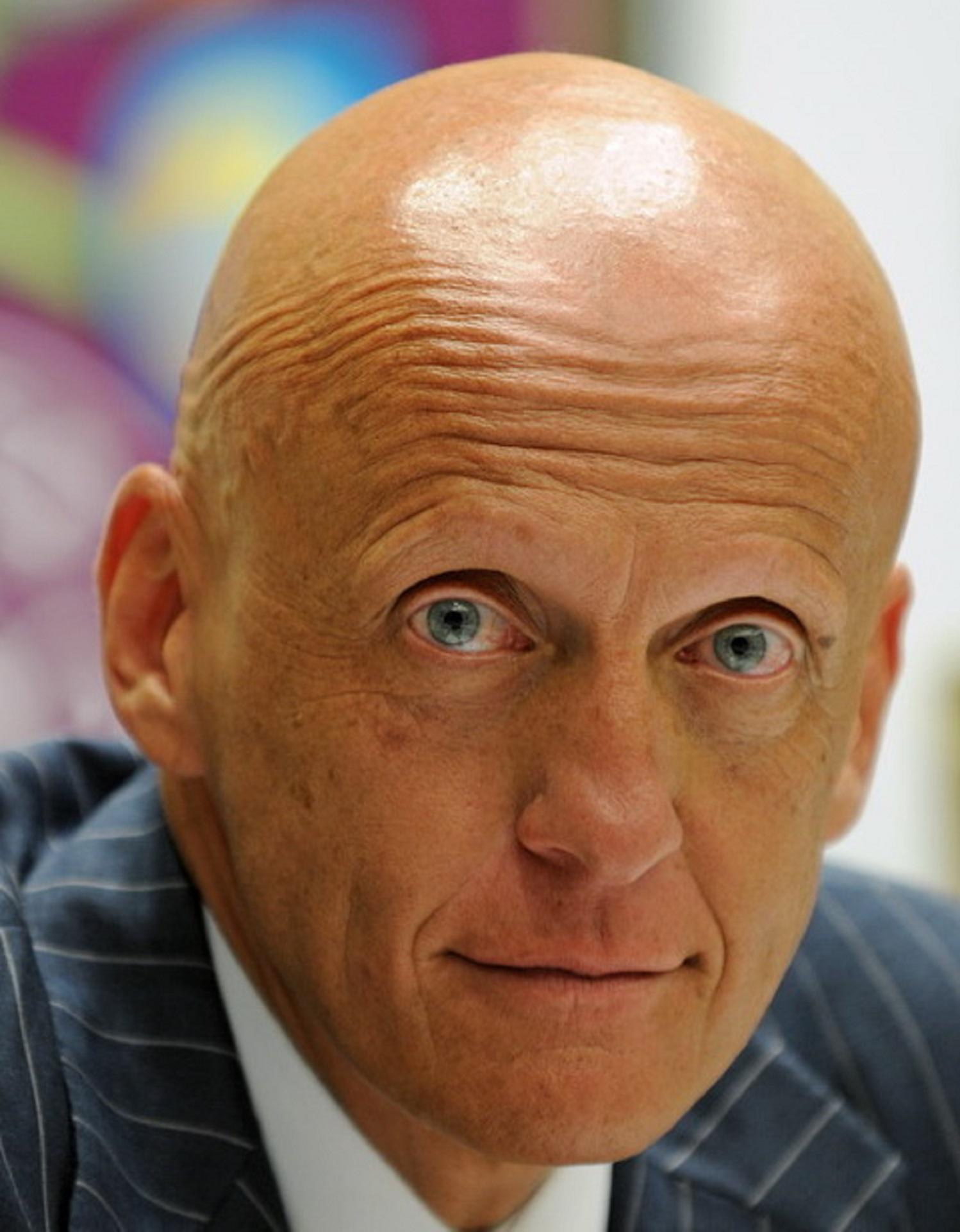 A bald man in a suit looks intently at the camera. 