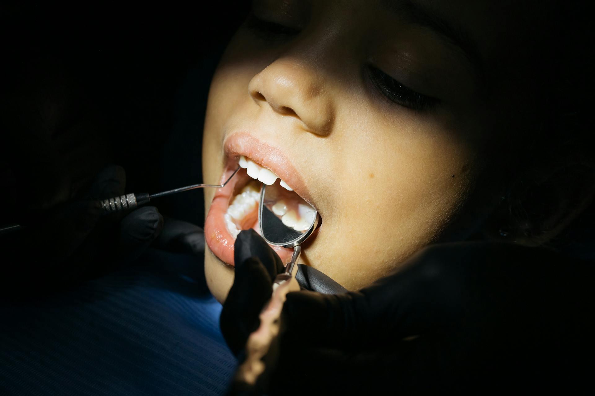 Dental procedure 